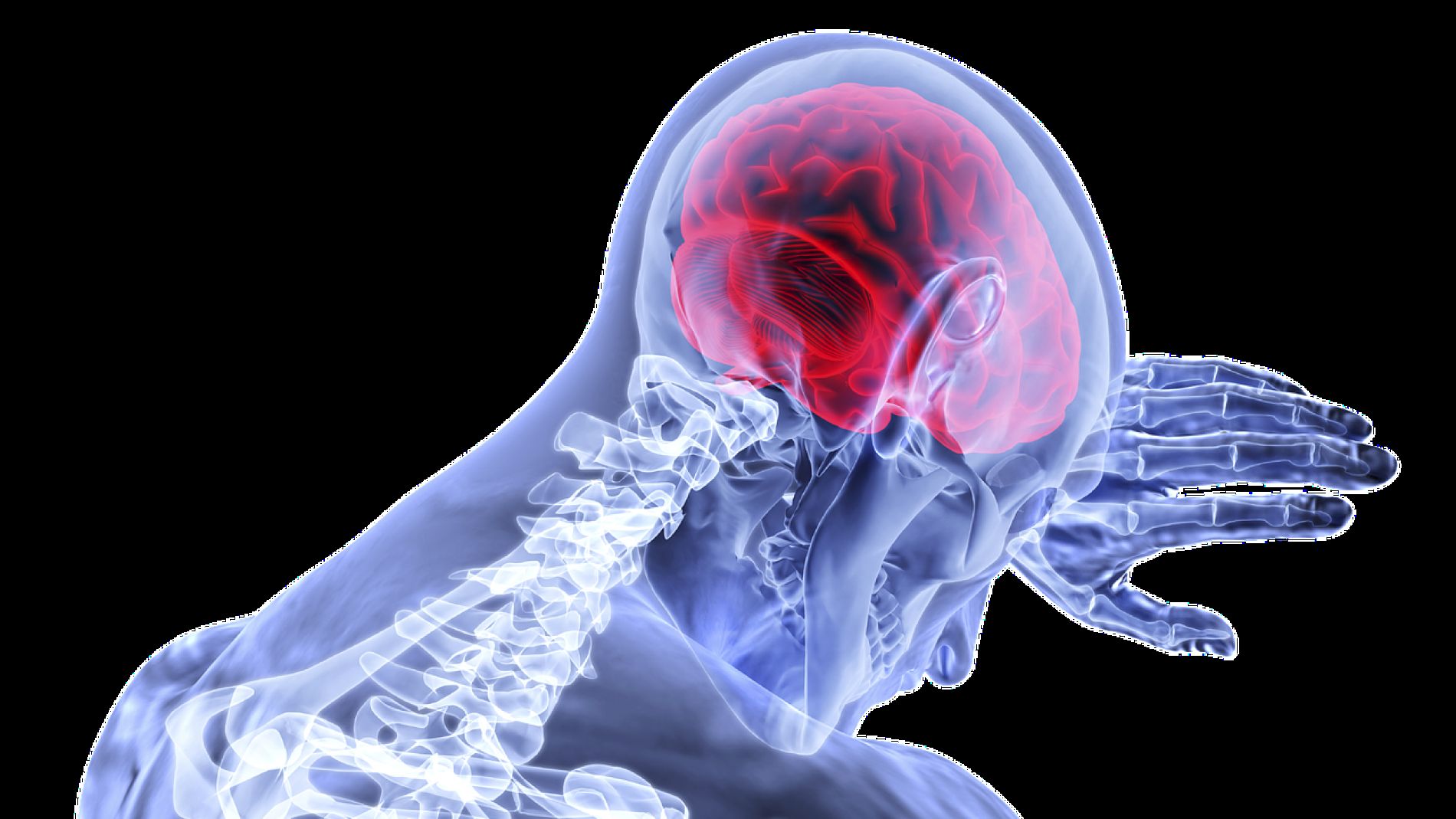 Cerebro