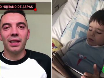 AspasJugones AspasJugones