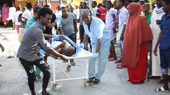 Imagen de un herido tras la explosión de un coche bomba en Somalia Imagen de un herido tras la explosión de un coche bomba en Somalia