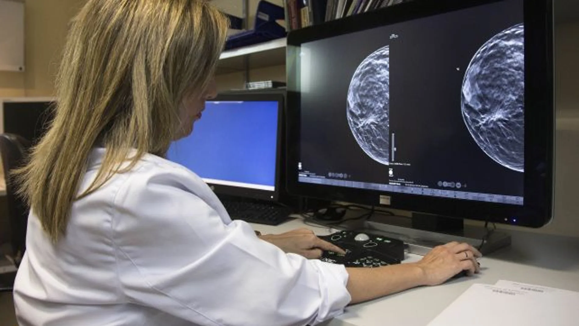 Una doctora evalúa una mamografía. 