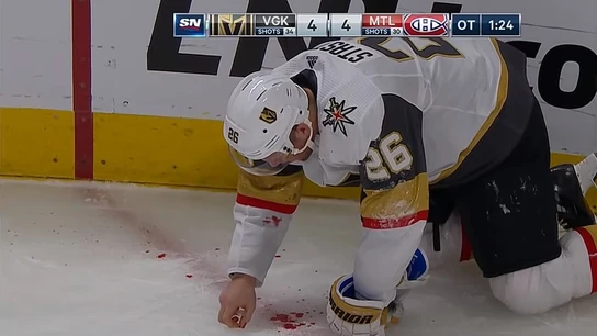 Paul Stastny golpeado accidentalmente por la pastilla Paul Stastny golpeado accidentalmente por la pastilla