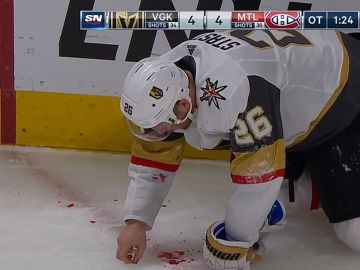 Paul Stastny golpeado accidentalmente por la pastilla Paul Stastny golpeado accidentalmente por la pastilla
