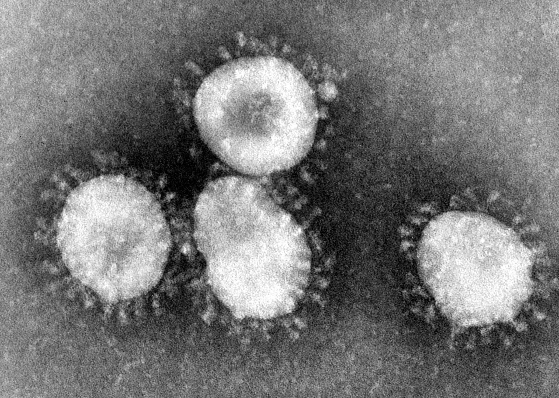 Imagen de un coronavirus