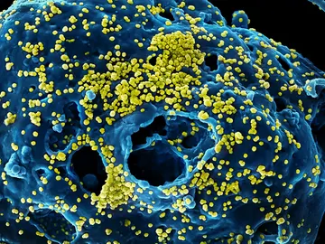 Partículas de un coronavirus Partículas de un coronavirus