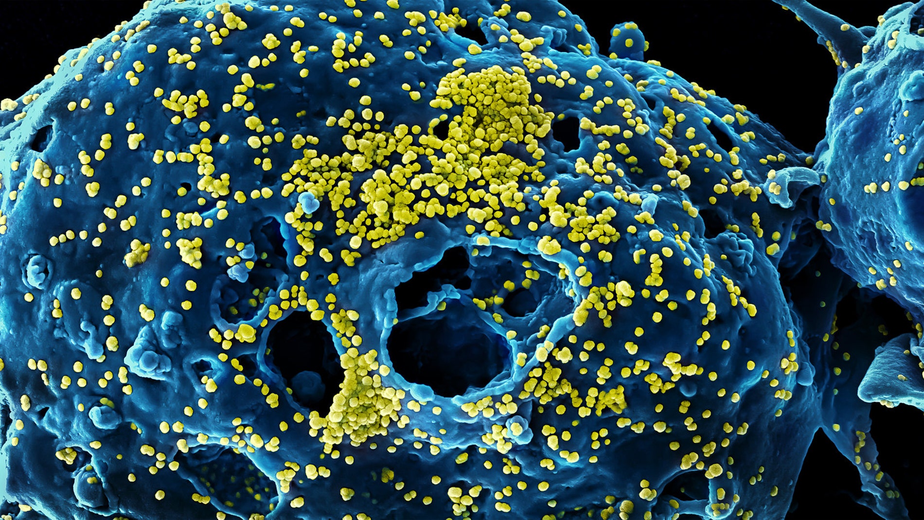 Partículas de un coronavirus