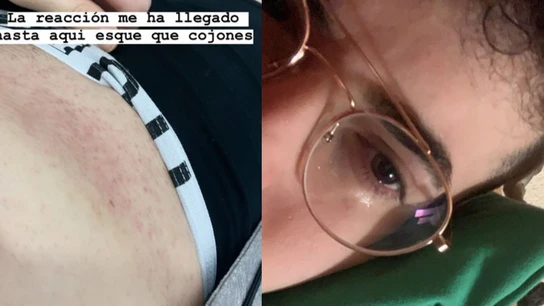 Edgar Aragall, víctima de una agresión homófoba Edgar Aragall