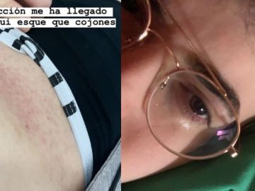 Edgar Aragall, víctima de una agresión homófoba Edgar Aragall, víctima de una agresión homófoba