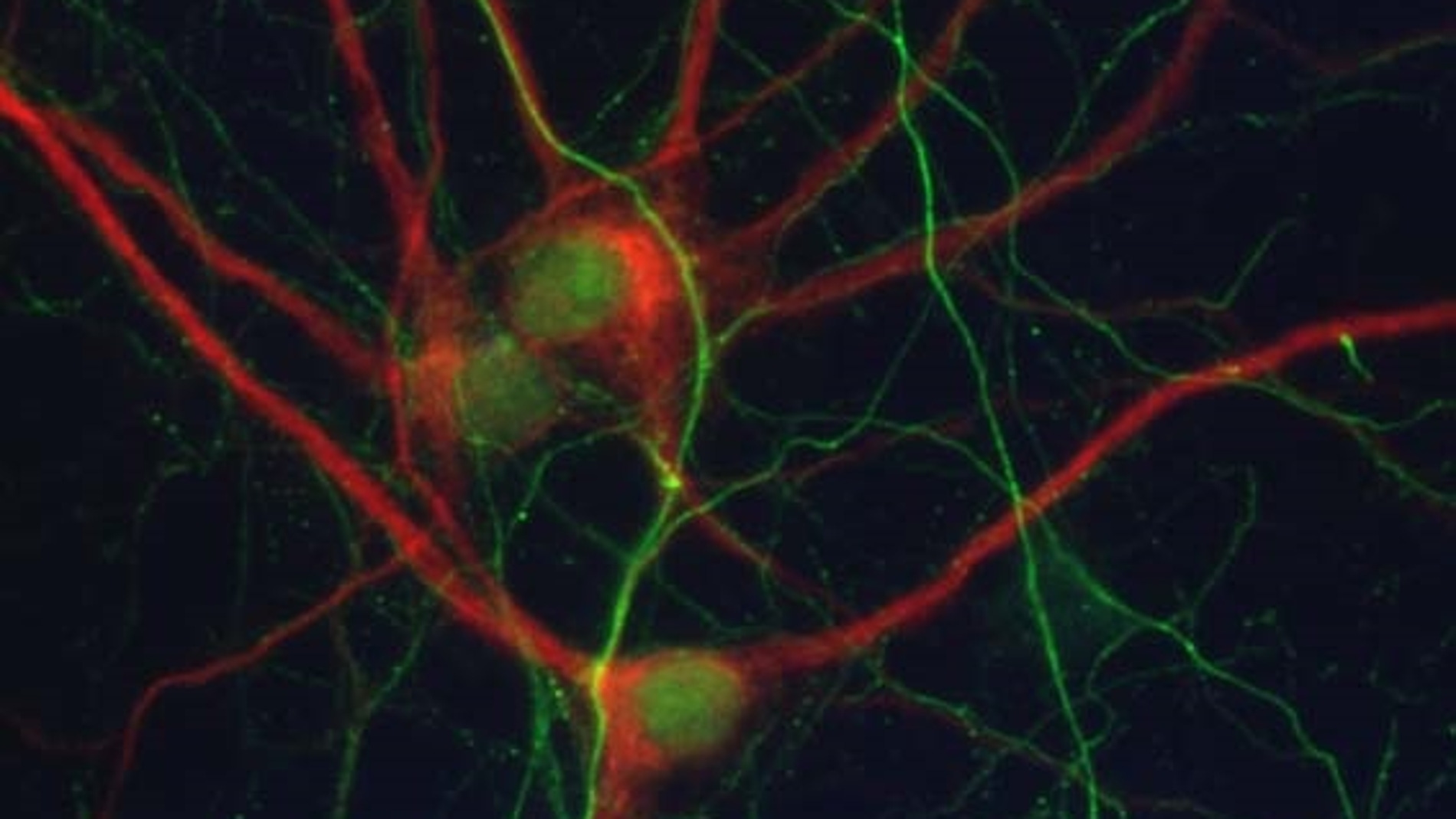 Imagen de un cultivo primario neuronal