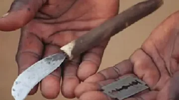 Herramientas usadas para una mutilación genital femenina (FGM).