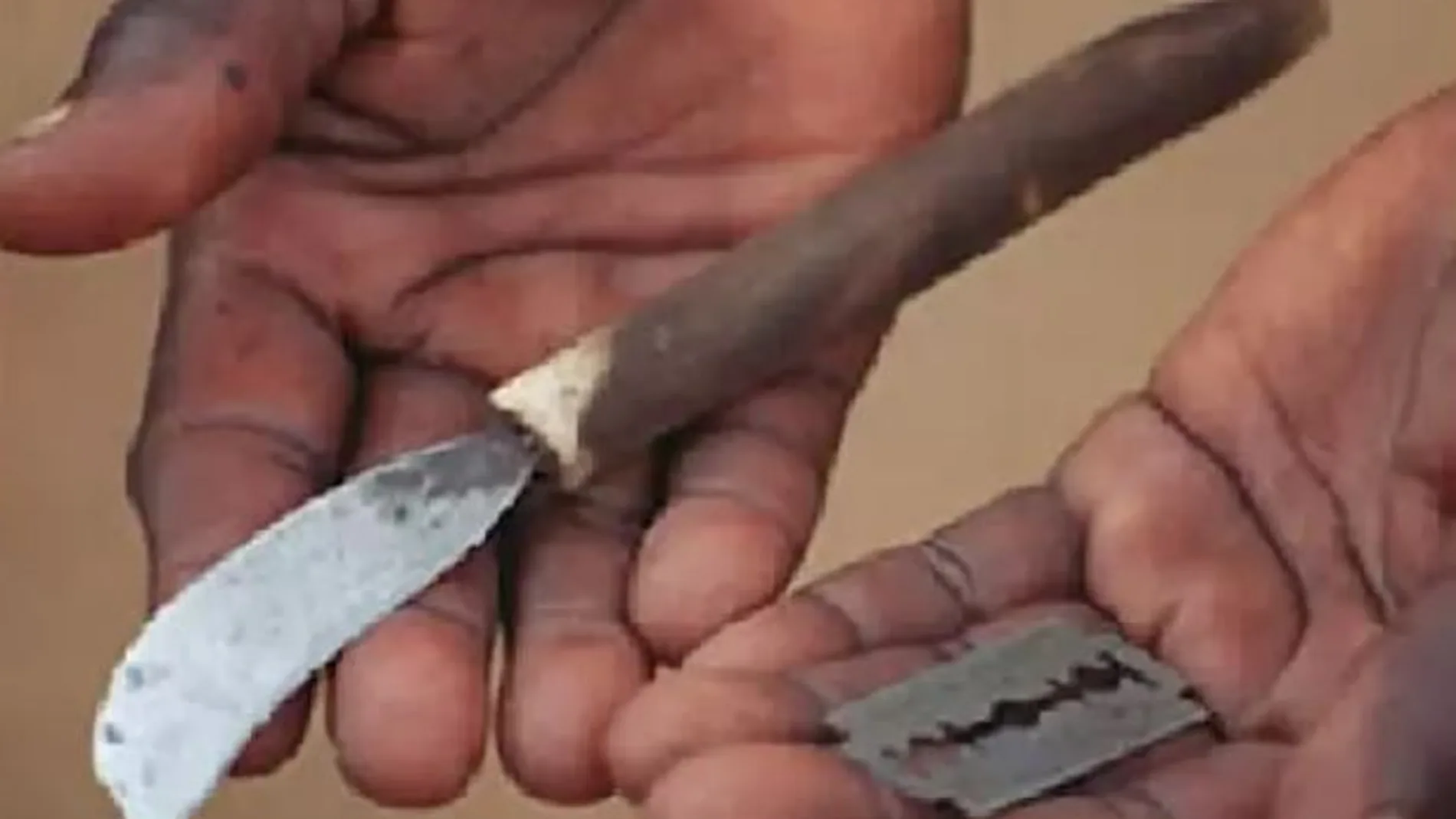 Herramientas usadas para una mutilación genital femenina (FGM).