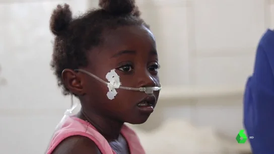 Sarampión, la enfermedad con vacuna que ya ha matado a 4.500 niños desde 2019 Sarampión, la enfermedad con vacuna que ya ha matado a 4.500 niños desde 2019