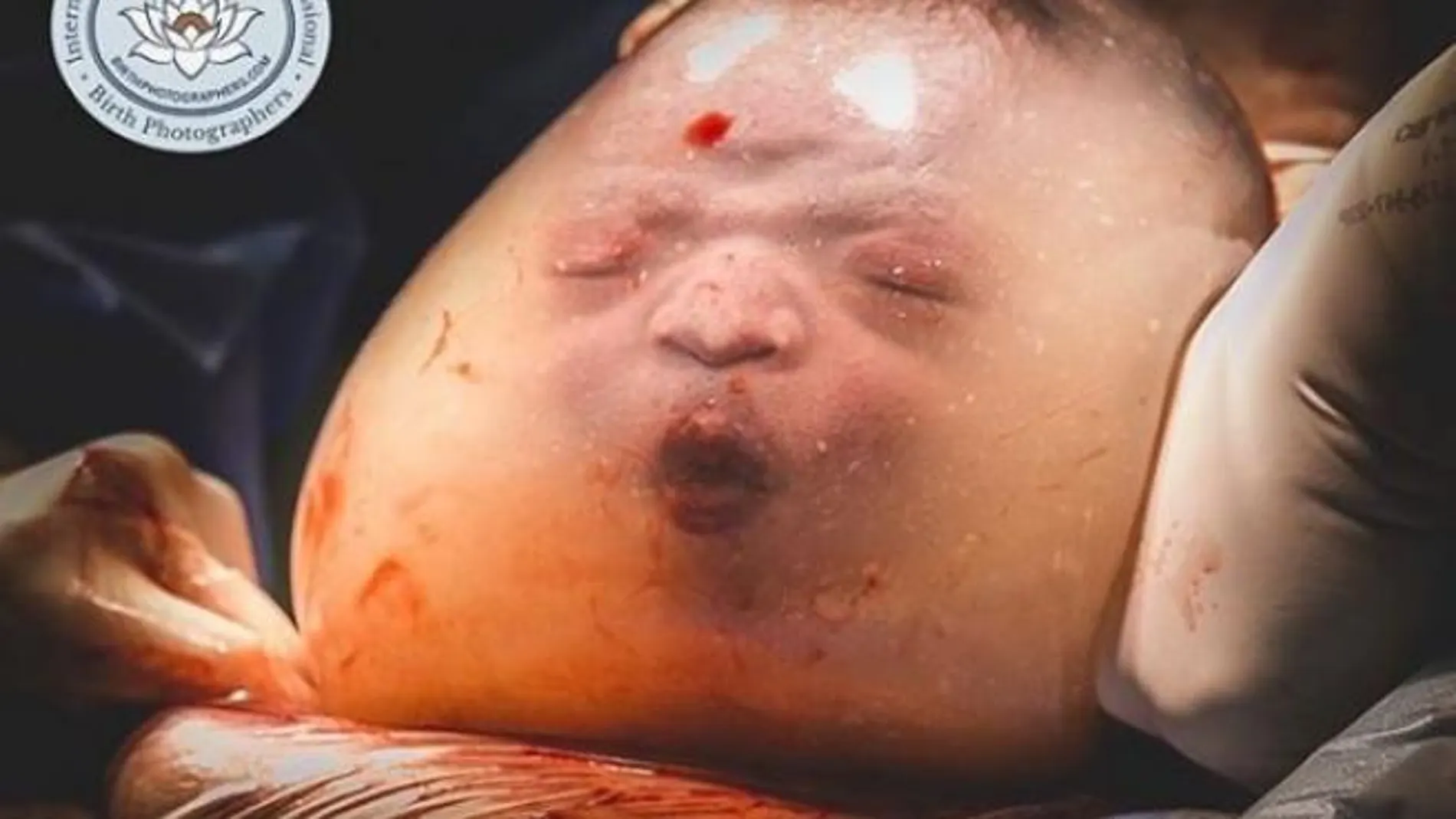 Bebé en una bolsa amniótica