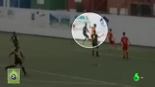 Un futbolista se rompe las dos muñecas tras un duro golpe... y la ambulancia tarda 40 minutos en llegar Un futbolista se rompe las dos muñecas tras un duro golpe... y la ambulancia tarda 40 minutos en llegar