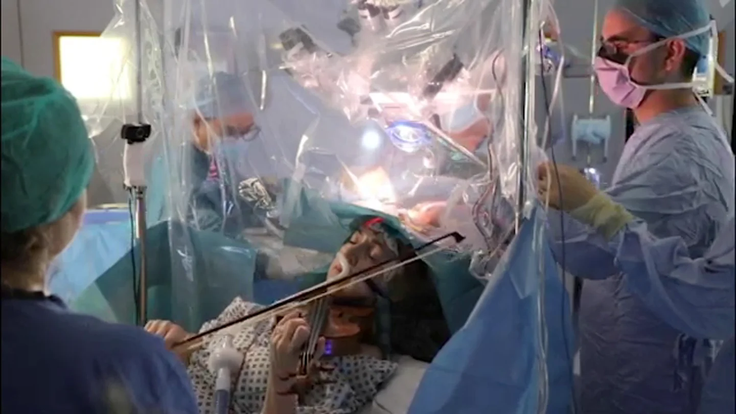 Una mujer consigue tocar el violín mientras le extirpan un tumor del cerebro Una mujer consigue tocar el violín mientras le extirpan un tumor del cerebro