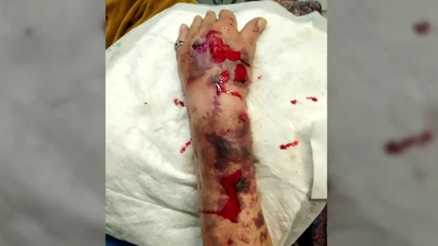 El brazo del anciano tras sufrir la agresión El brazo del anciano tras sufrir la agresión