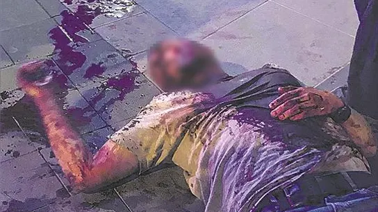 La víctima después de la agresión La víctima después de la agresión