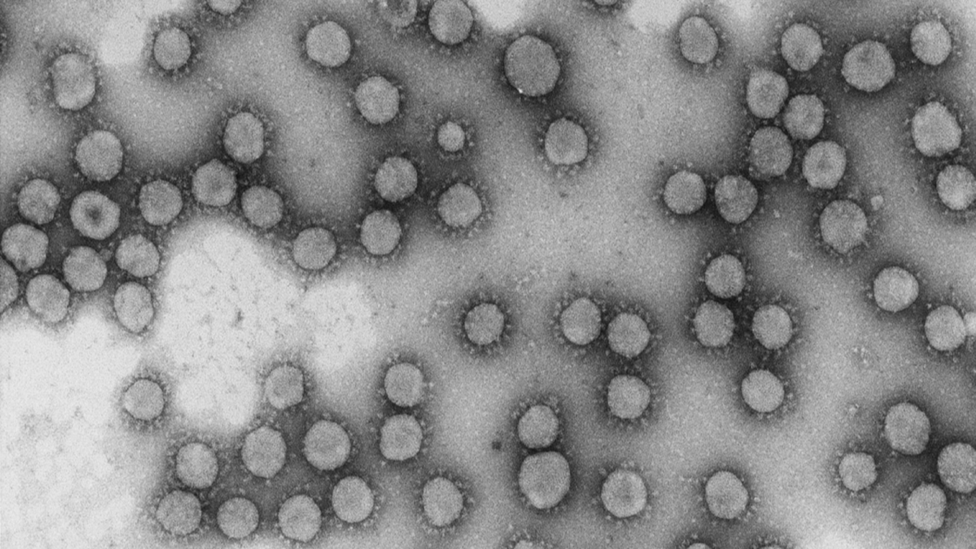 Dos proyectos espanoles logran financiacion europea para investigar el coronavirus