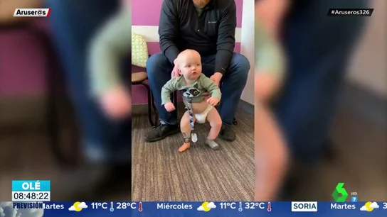 La ternura del pequeño Brooks: un bebé con una sola pierna que camina por primera vez La ternura del pequeño Brooks: un bebé con una sola pierna que camina por primera vez