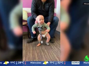 La ternura del pequeño Brooks: un bebé con una sola pierna que camina por primera vez La ternura del pequeño Brooks: un bebé con una sola pierna que camina por primera vez