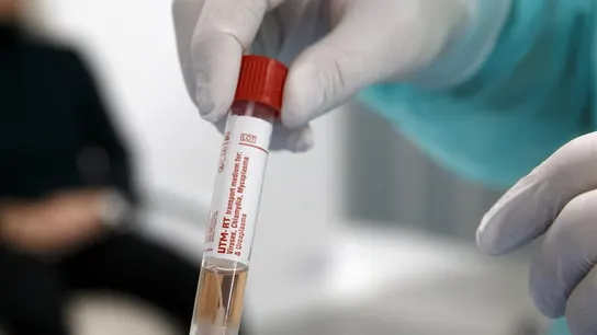 Muestra de una persona sospechosa de estar infectada con el coronavirus Muestra de una persona sospechosa de estar infectada con el coronavirus