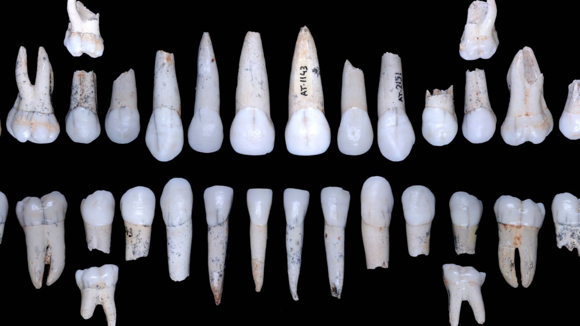 El esmalte de los hominidos de Atapuerca crecia mas rapido que el de los humanos modernos