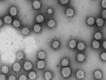 Resultado prometedor de un farmaco contra el mieloma que logra frenar un coronavirus humano Resultado prometedor de un farmaco contra el mieloma que logra frenar un coronavirus humano