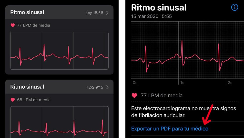 Exportar un ECG para enviar al médico