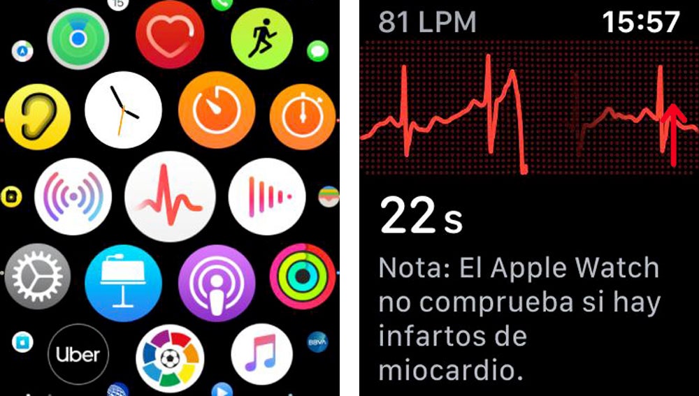 Cómo hacer electrocardiogramas con el Apple Watch