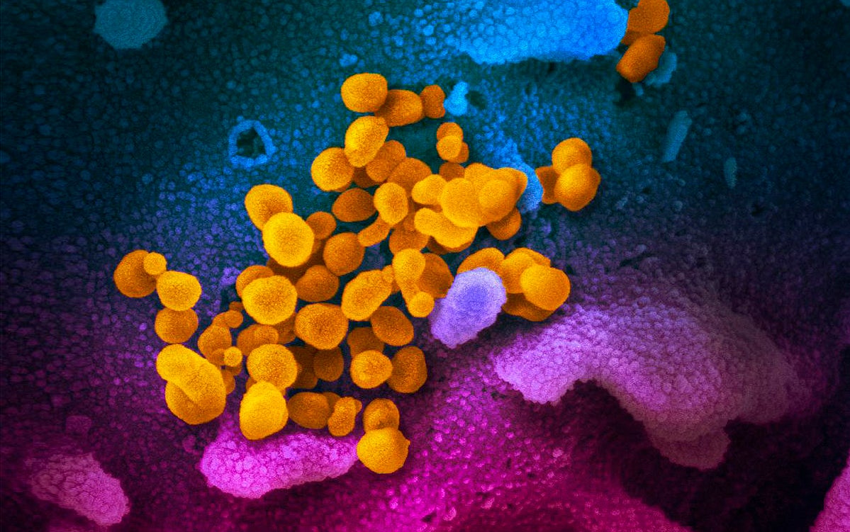 Este es el tiempo que dura el SARS CoV 2 en diversas superficies