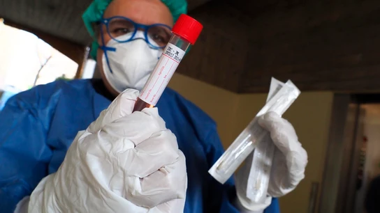 Prueba de diagnóstico del coronavirus Prueba de diagnóstico del coronavirus