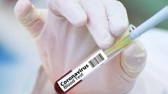 Científicos alemanes establecen momento en que paciente ya no es contagioso Científicos alemanes establecen momento en que paciente ya no es contagioso