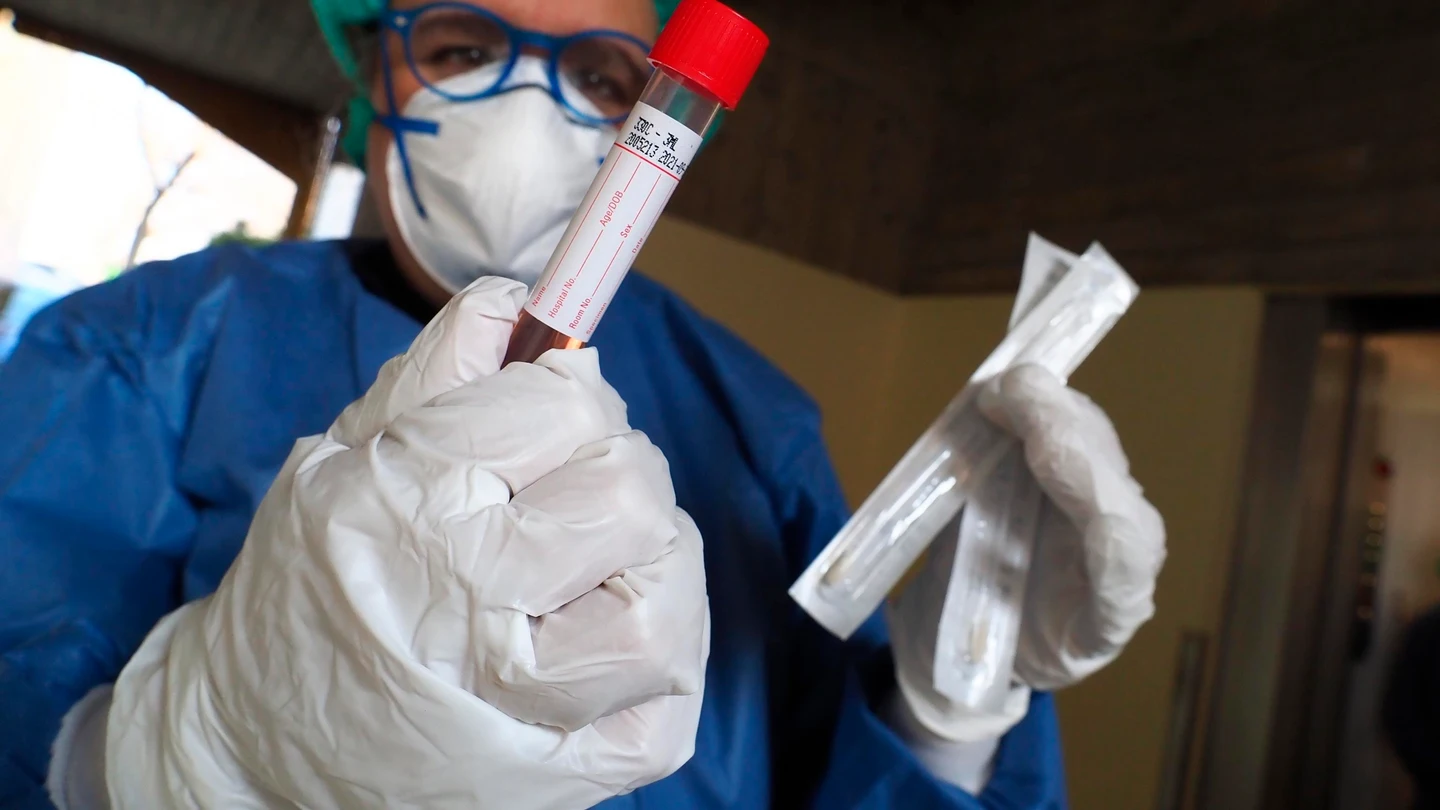 Test de coronavirus Coronavirus