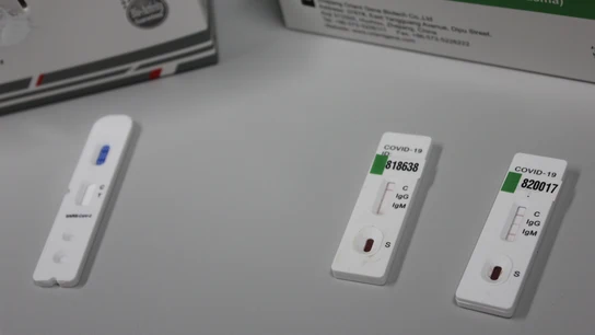 Reino Unido ofrece test gratuitos de coronavirus a las empresas para detectar contagios entre sus empleados Reino Unido ofrece test gratuitos de coronavirus a las empresas para detectar contagios entre sus empleados