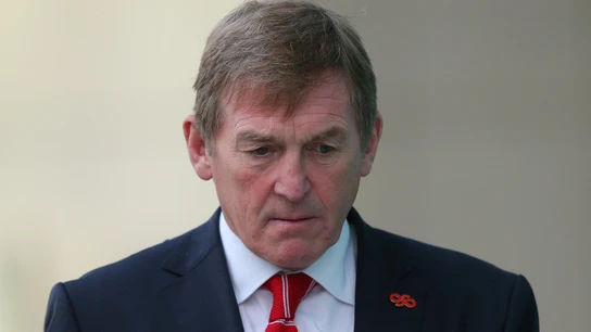 Kenny Dalglish Kenny Dalglish