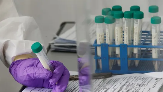 Tubos de ensayo Tubos de ensayo