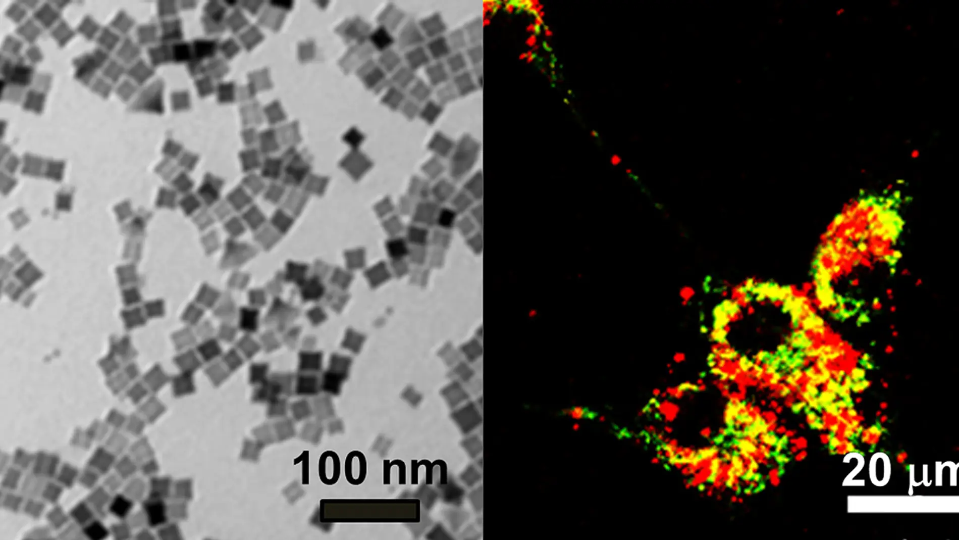 Nanocubos magneticos para luchar contra el cancer