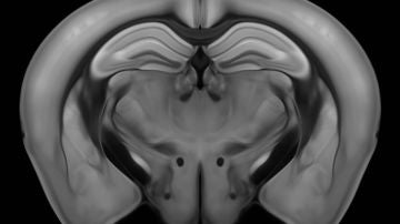 Cerebro de ratón