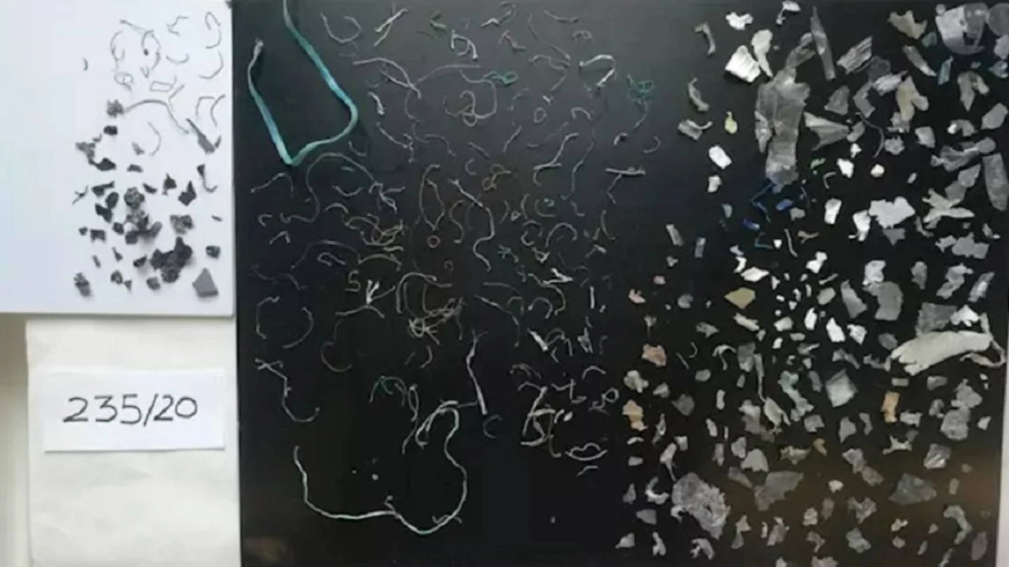 Imagen de los plásticos que se han extraído del interior de una tortuga en Gran Canaria Imagen de los plásticos que se han extraído del interior de una tortuga en Gran Canaria