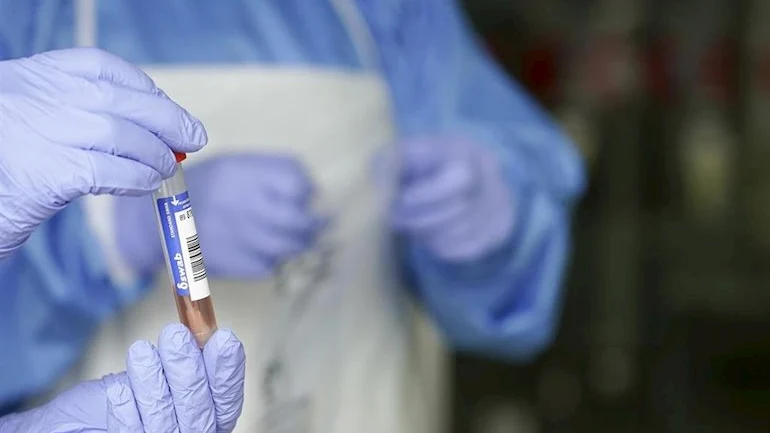 Un sanitario protegido con guantes sostiene un muestra para realizar un Análisis PCR 