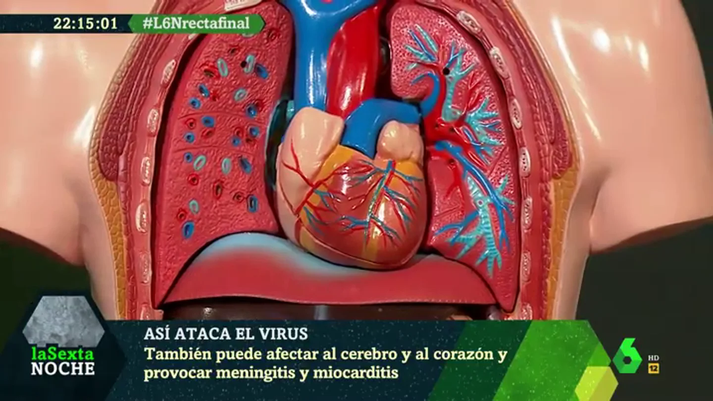 Así ataca el COVID-19 a nuestros órganos: puede afectar al cerebro y al corazón Así ataca el COVID-19 a nuestros órganos: puede afectar al cerebro y al corazón