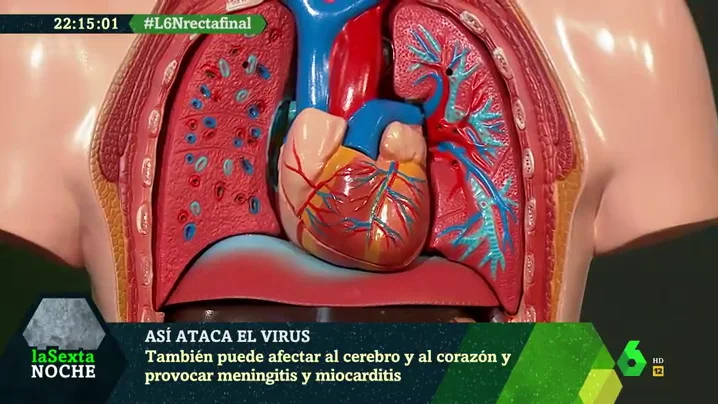 Así ataca el COVID-19 a nuestros órganos: puede afectar al cerebro y al corazón