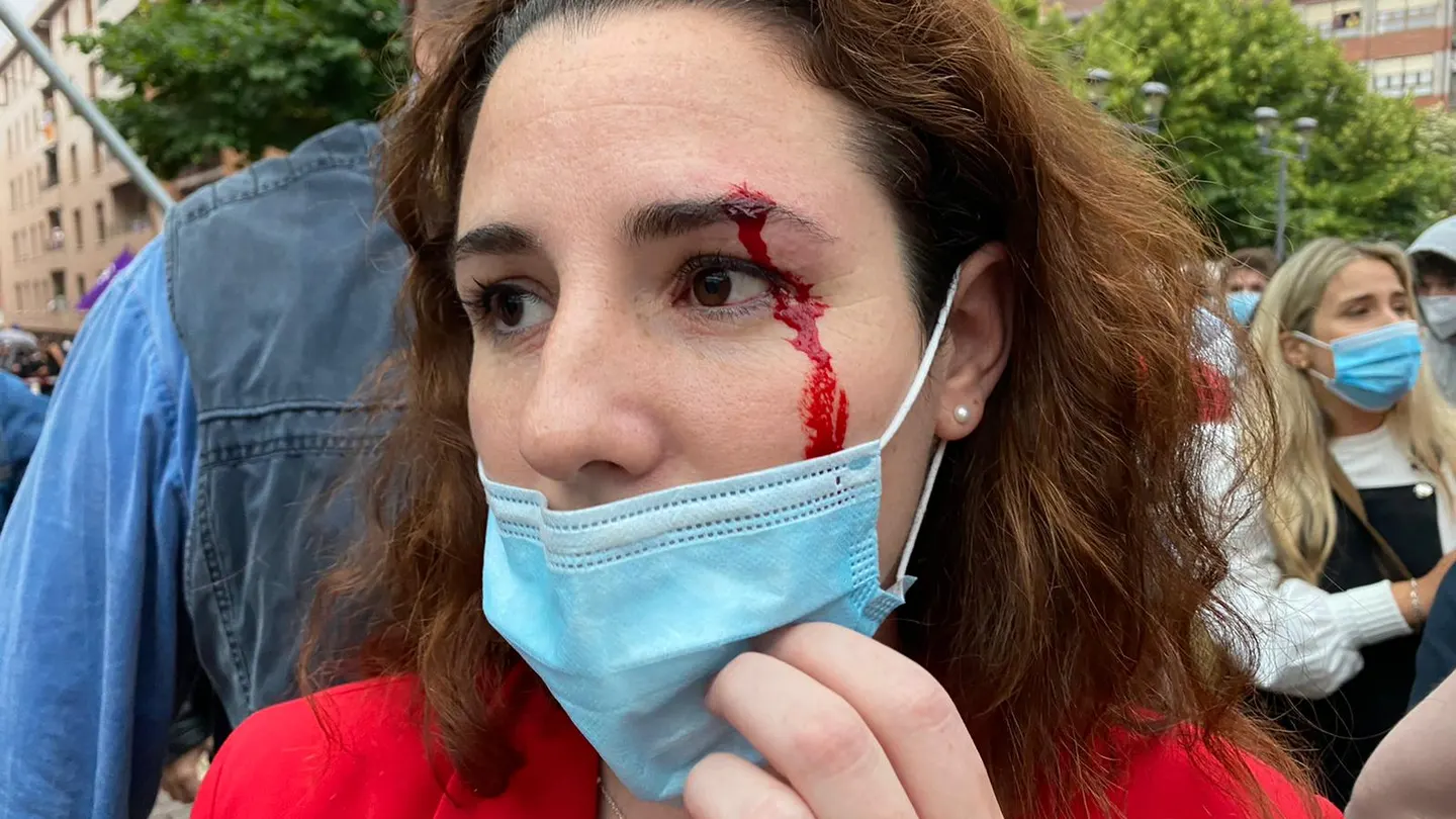 La diputada de Vox Rocío de Meer, herida La diputada de Vox Rocío de Meer, herida