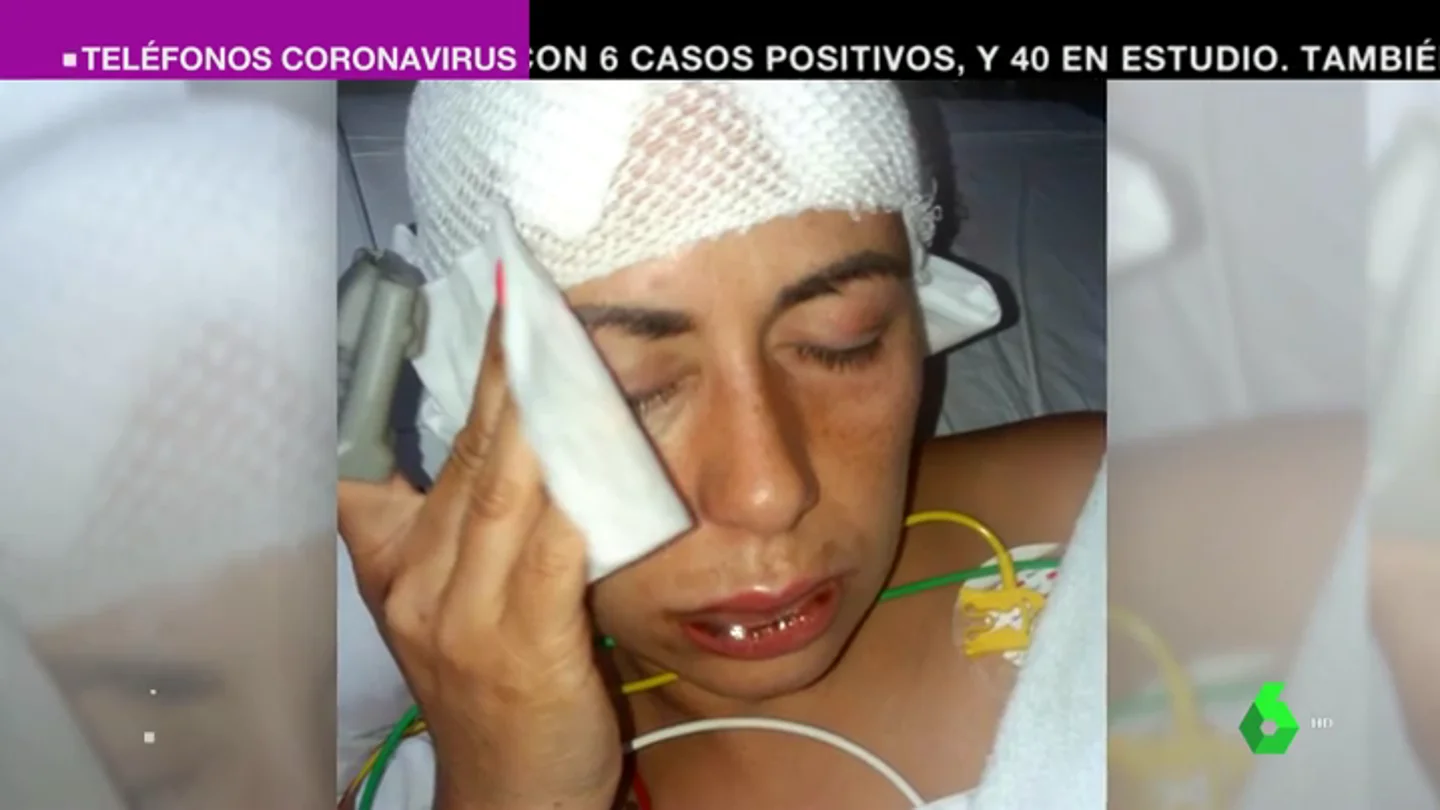 Ana María denunció al hombre que le tiró sosa cáustica por chantajearla con fotos sexuales: "Se las enviaba a mi marido" Ana María denunció al hombre que le tiró sosa cáustica por chantajearla con fotos sexuales: "Se las enviaba a mi marido"
