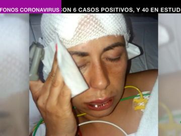 Ana María denunció al hombre que le tiró sosa cáustica por chantajearla con fotos sexuales: "Se las enviaba a mi marido" Ana María denunció al hombre que le tiró sosa cáustica por chantajearla con fotos sexuales: "Se las enviaba a mi marido"