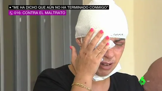 El testimonio de la mujer que fue rociada con sosa cáustica en Girona: "Cuando salga de la cárcel va a venir a por mí" El testimonio de la mujer que fue rociada con sosa cáustica en Girona: "Cuando salga de la cárcel va a venir a por mí"