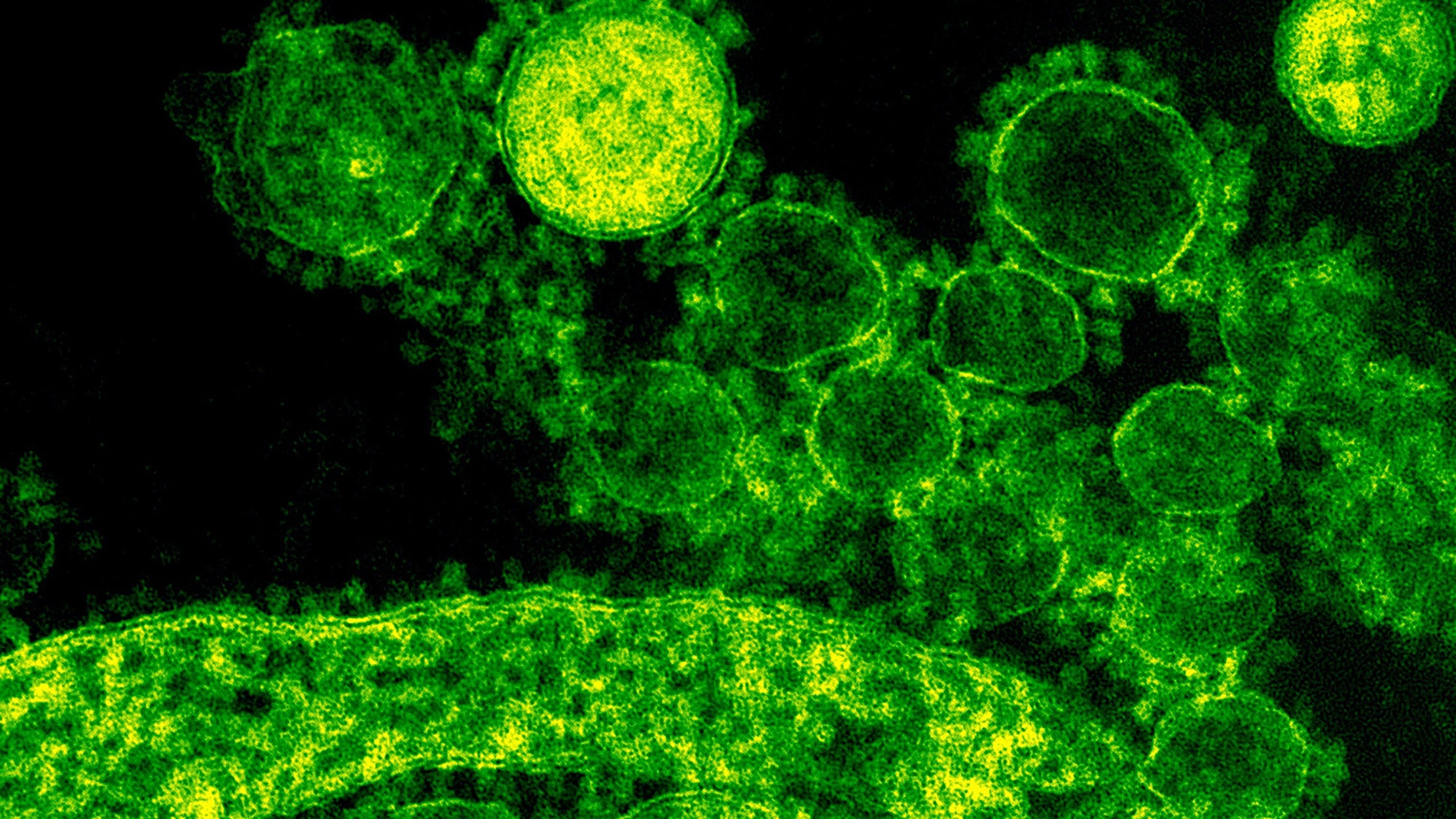 Nuevos estudios para tratar el coronavirus hasta que haya vacuna
