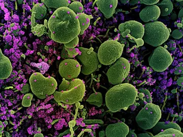 Micrografía Micrografía