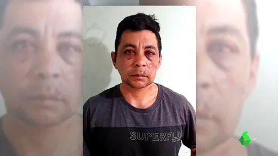 Varios vecinos apalean a un enfermero, le roban el coche y prenden fuego a su casa después de que sufriera la Covid-19 Varios vecinos apalean a un enfermero, le roban el coche y prenden fuego a su casa después de que sufriera la Covid-19