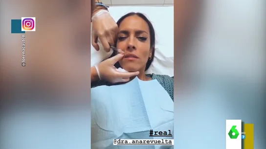 El momento en el que a Lorena Castell le pinchan ácido hialurónico para aumentarse el labio El momento en el que a Lorena Castell le pinchan ácido hialurónico para aumentarse el labio