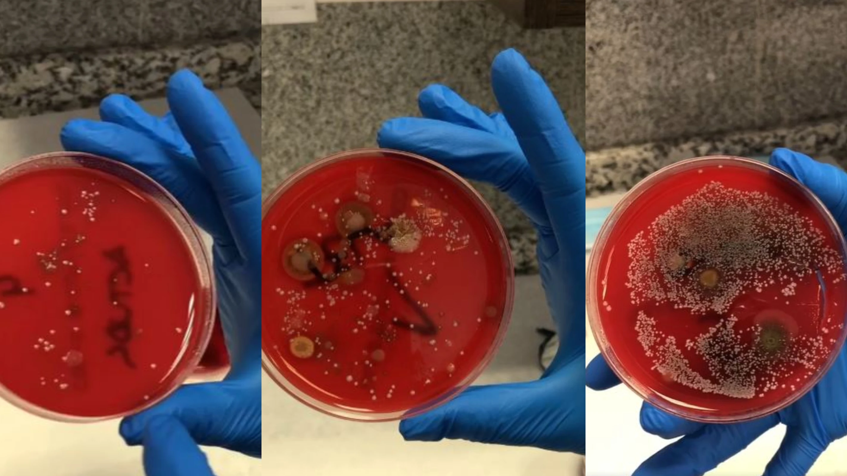 El experimento que muestra por qué no hay que usar la mascarilla más tiempo del recomendado